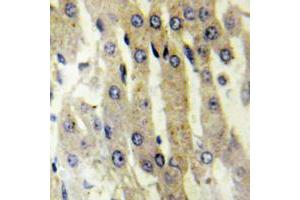 Immunohistochemical analysis of ACAD10 staining in human liver formalin fixed paraffin embedded tissue section. (ACAD10 anticorps  (Center))