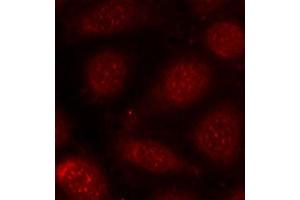 Immunofluorescence staining of methanol-fixed MCF-7 cells using Phospho-PRKCB-T641 antibody (ABIN2987563). (PKC beta anticorps  (pThr641))