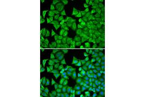 Immunofluorescence analysis of MCF-7 cell using RRM1 antibody. (RRM1 anticorps)