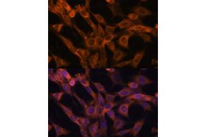 Immunofluorescence analysis of NIH-3T3 cells using R antibody (ABIN6128592, ABIN6146556, ABIN6146557 and ABIN6215667) at dilution of 1:100.