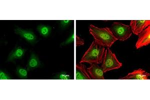 ICC/IF Image p27 Kip1 antibody detects p27 Kip1 protein at cytoplasm and nucleus by immunofluorescent analysis.
