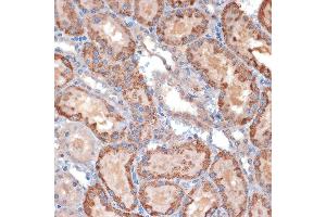 Immunohistochemistry of paraffin-embedded rat kidney using TIMM50 Rabbit mAb (ABIN1513120, ABIN3022092, ABIN3022093 and ABIN7101443) at dilution of 1:100 (40x lens).