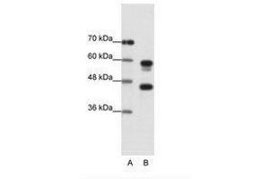 Image no. 1 for anti-Proteasome (Prosome, Macropain) 26S Subunit, ATPase, 5 (PSMC5) (C-Term) antibody (ABIN202447) (PSMC5 anticorps  (C-Term))