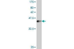 Western Blot detection against Immunogen (36. (SSX4 anticorps  (AA 91-188))