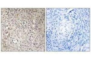 Immunohistochemistry analysis of paraffin-embedded human ovary tissue using GCNT7 antibody. (GCNT7 anticorps)