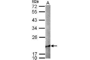 WB Image Sample (50 ug of whole cell lysate) A: mouse brain 12% SDS PAGE antibody diluted at 1:1000 (Cofilin 2 anticorps)