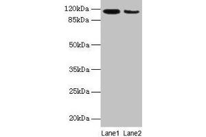 Western blot All lanes: ATP2A2 antibody at 6 μg/mL Lane 1: Mouse heart tissue Lane 2: Mouse skeletal muscle tissue Secondary Goat polyclonal to rabbit IgG at 1/10000 dilution Predicted band size: 115, 110, 112 kDa Observed band size: 115 kDa