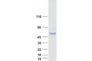 Validation with Western Blot