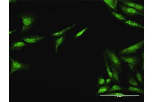Immunofluorescence of purified MaxPab antibody to CDC25A on HeLa cell. (CDC25A anticorps  (AA 1-524))