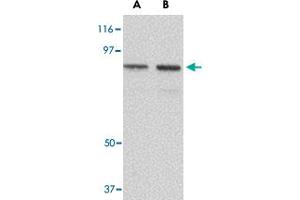 Western blot analysis of NUP107 in A-549 cell lysate with NUP107 polyclonal antibody  at (A) 1 and (B) 2 ug/mL . (NUP107 anticorps  (C-Term))