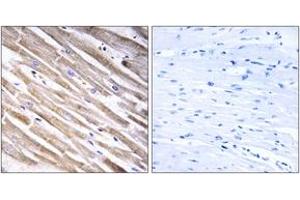 Immunohistochemistry analysis of paraffin-embedded human heart tissue, using RPL3L Antibody.