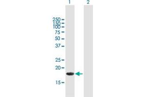 Western Blot analysis of ALG13 expression in transfected 293T cell line by ALG13 MaxPab polyclonal antibody. (ALG13 anticorps  (AA 1-165))