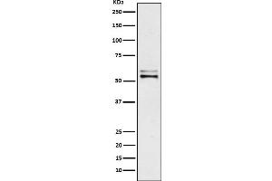 Western blot analysis of Angiotensinogen expression in Human plasma lysate.