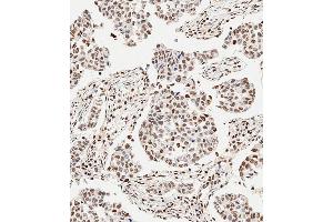 anti-GLI Family Zinc Finger 2 (GLI2) (AA 1287-1321), (C-Term) antibody