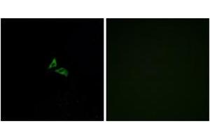 Immunofluorescence analysis of A549 cells, using EDG7 Antibody. (LPAR3 anticorps  (AA 281-330))