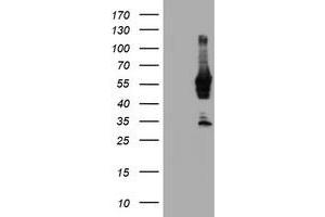 Western Blotting (WB) image for anti-N-Myristoyltransferase 2 (NMT2) antibody (ABIN1499782)