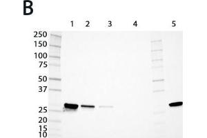 Expression analysis of rat GSTs of the mu and alpha classes.