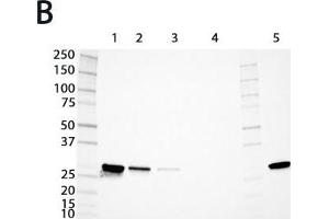 Expression analysis of rat GSTs of the mu and alpha classes. (GSTM4 anticorps  (AA 21-215))