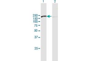 Western Blot analysis of SMC3 expression in transfected 293T cell line by SMC3 MaxPab polyclonal antibody. (SMC3 anticorps  (AA 1-1217))