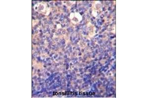 KLRC2 Antibody (N-term) (ABIN652570 and ABIN2842383) immunohistochemistry analysis in formalin fixed and paraffin embedded human tonsillitis tissue followed by peroxidase conjugation of the secondary antibody and DAB staining. (KLRC2 anticorps  (N-Term))