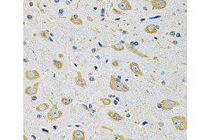 Immunohistochemistry of paraffin-embedded Mouse brain using FASTKD1 Polyclonal Antibody at dilution of 1:100 (40x lens). (FASTKD1 anticorps)