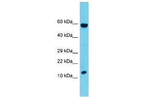 Host: Rabbit  Target Name: Cd247  Sample Tissue: Rat Thymus lysates  Antibody Dilution: 1. (CD247 anticorps  (C-Term))