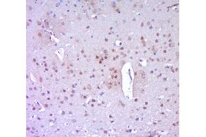 Paraformaldehyde-fixed, paraffin embedded mouse brain, Antigen retrieval by boiling in sodium citrate buffer (pH6.