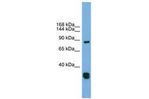 Image no. 1 for anti-Follistatin-Like 5 (FSTL5) (C-Term) antibody (ABIN6744178) (FSTL5 anticorps  (C-Term))