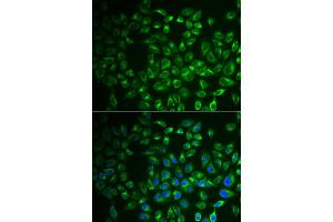 Immunofluorescence analysis of A549 cell using FABP6 antibody. (FABP6 anticorps)