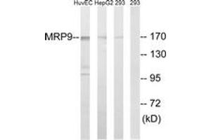 Western blot analysis of extracts from 293/HepG2/HuvEc cells, using MRP9 Antibody. (ABCC12 anticorps  (AA 691-740))