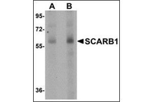 Western blot analysis of SCARB1 in human spleen tissue lysate with this product at (A) 1 and (B) 2 μg/ml. (SCARB1 anticorps  (N-Term))