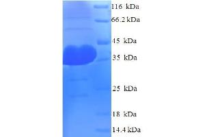 SDS-PAGE (SDS) image for Argonaute 2 (AGO2) (AA 517-818) protein (His tag) (ABIN5711955)