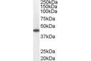 Medium-Chain Specific Acyl-CoA Dehydrogenase, Mitochondrial (MCAD) peptide