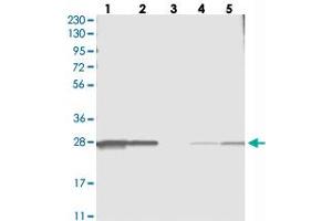 Western blot analysis of Lane 1: RT-4, Lane 2: U-251 MG, Lane 3: Human Plasma, Lane 4: Liver, Lane 5: Tonsil with C11orf73 polyclonal antibody  at 1:250-1:500 dilution. (C11orf73 anticorps)
