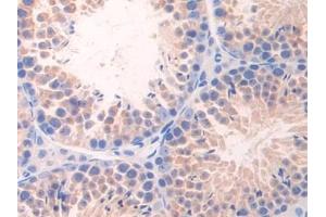 Detection of NCAD in Mouse Testis Tissue using Polyclonal Antibody to N-cadherin (NCAD)