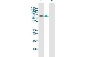 Western Blot analysis of IRAK3 expression in transfected 293T cell line by IRAK3 MaxPab polyclonal antibody. (IRAK3 anticorps  (AA 1-596))