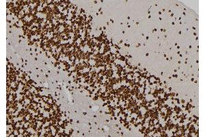 ABIN6276995 at 1/100 staining Rat brain tissue by IHC-P.