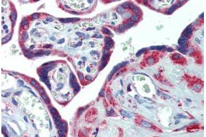 Placenta, Human: Formalin-Fixed, Paraffin-Embedded (FFPE)