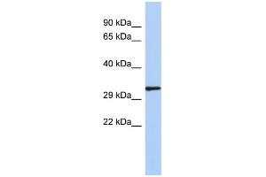 WB Suggested Anti-NKX2-2 Antibody Titration:  0.