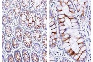Immunohistochemical staining (Formalin-fixed paraffin-embedded sections) analysis of human small intestine with ECM1 monoclonal antibody, clone SC05  at 1:500 using peroxidase-conjugate and DAB chromogen (Note: cytoplasmic and membrane staining).
