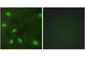 Immunofluorescence analysis of HeLa cells, using GIRK1/KIR3. (KCNJ3 anticorps  (pSer185))