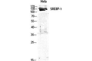 Western Blotting (WB) image for anti-Sterol Regulatory Element Binding Transcription Factor 1 (SREBF1) (Tyr1175) antibody (ABIN3177512) (SREBF1 anticorps  (Tyr1175))