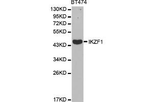Western blot analysis of extracts of BT-474 cells, using IKZF1 antibody (ABIN5970949) at 1/1000 dilution. (IKZF1 anticorps)