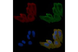 ABIN6258560 and ABIN6275594 staining Hela cells(30 min of UV treatment) by IF/ICC.