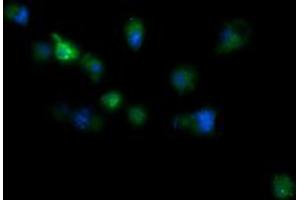 Image no. 1 for anti-RIO Kinase 2 (RIOK2) (AA 277-552) antibody (ABIN1491305) (RIOK2 anticorps  (AA 277-552))