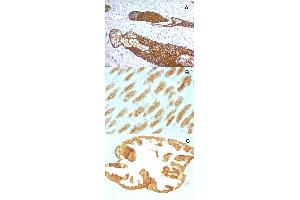 Immunohistochemical staining (Formalin-fixed paraffin-embedded sections) of (A) human skin (B) rat stomach and (C) rat oviduct with KRT76 monoclonal antibody, clone KRTH/1076 . (Cytokeratin 2 anticorps)
