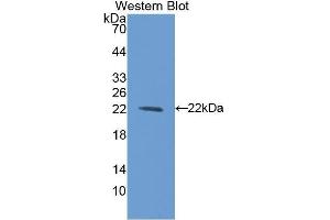Western Blotting (WB) image for anti-Bleomycin Hydrolase (BLMH) (AA 30-165) antibody (ABIN1175602) (BLMH anticorps  (AA 30-165))