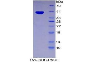 SDS-PAGE analysis of Human Pygopus Homolog 1 Protein.