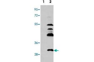 Western blot analysis of UCK2 (arrow) using UCK2 polyclonal antibody . (UCK2 anticorps  (C-Term))