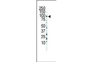 Western blot analysis of anti-FGFR3 Pab (ABIN391969 and ABIN2841765) in Jurkat cell lysate.